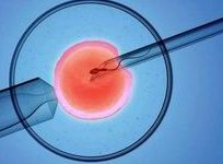 排卵障碍不容忽视，不孕大多是其原因！濮阳市哪家医院擅长排卵障碍试管方案？